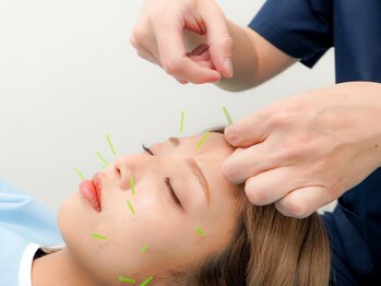 すかい鍼灸整体院の写真/【美容鍼でお肌のハリ艶UP☆】気になるむくみやシワたるみを改善!キュッと引き締まったふっくら肌に♪