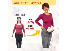 アロエ(Aloe)