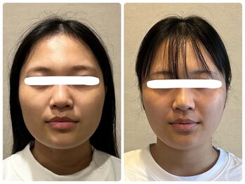 板橋本町整体院/☆ビフォーアフター例☆