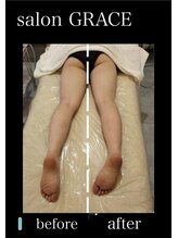 サロン グレイス(salon GRACE)/美骨矯正