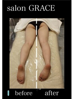 サロン グレイス(salon GRACE)/美骨矯正