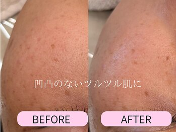 ケアズ(CARES)/フェイシャルワックス