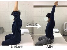 ライフタイムビューティー 福島店(Life Time Beauty)の雰囲気(2ヶ月でこの結果! 月2回のストレッチで肩こり改善!!)