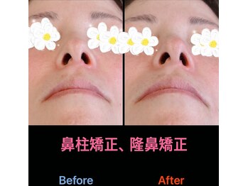 美容矯正サロン レレポノ(LELEPONO)/