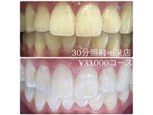 ホワイトニングルーム 横浜店(Whitening Room)/セルフホワイトニング/横浜