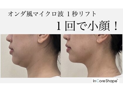 リアン 南熊本店(Lien)の写真