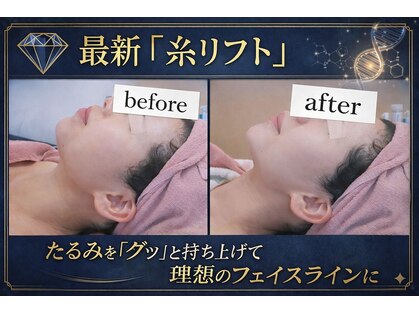 エターナル(Eternal)の写真