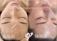 ロイヤル ビューティー サロン(Royal Beauty Saloon)
