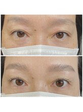 リブ(Lib)/骨格美眉アイブロウリフト