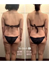ナチュール(NaTuRu)/ビフォーアフター★3回目/30代