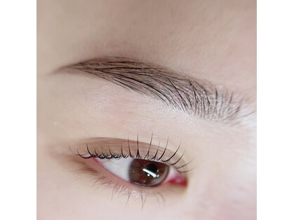 アイサプリメント(eye supplement)の写真