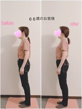 ソル(sol)/66歳のお客様 本格美容整体