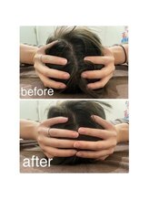 駒込整体院/小顔矯正・頭痛・眼精疲労