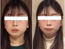 美容整体 ウェリナ 蟹江院/小顔矯正/骨盤矯正/美脚サロン 