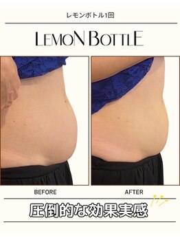 グラシーズ(Glasses)/レモンボトル