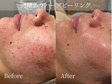 アパラギ(Aparagi)の雰囲気（【施術後の結果に納得】ハーブLv3~筋肉小顔矯正&アフターケア付）