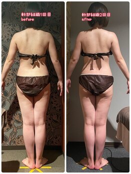 サンタイ(santai.)/筋膜リリース