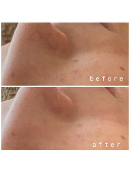 メナードフェイシャルサロン 岐阜茜部/春の弱肌ケア