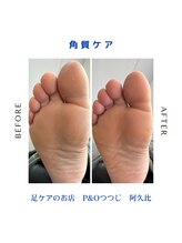 ピーアンドオー(P&O)/