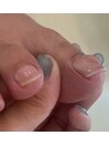 巻き爪補正/ケア