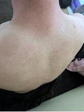 リデザイン 京都(REDESIGN)/REDESIGN京都中医施術法