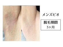 メンズビオ 神戸三宮店/