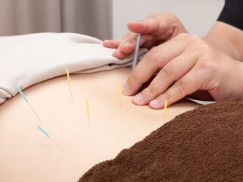 ただき接骨院 整体院 高関院の写真/自律神経の乱れに鍼×整体がオススメ★肩こり頭痛だるさにも効果的◎丁寧なカウンセリングで初めての方に◎