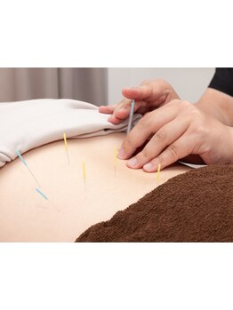 鍼灸施術を受けたい