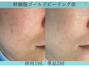 リメイククリニカルビューティー(Remake clinical beauty)/