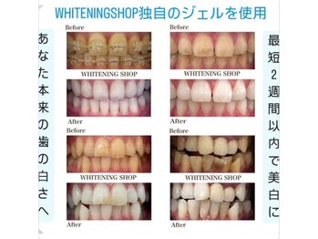 ホワイトニングショップ 水戸駅前店/【期間限定のお得なクーポン】