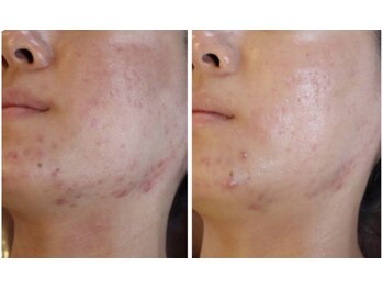 スリリアン 銀座/★お客さまビフォーアフター★