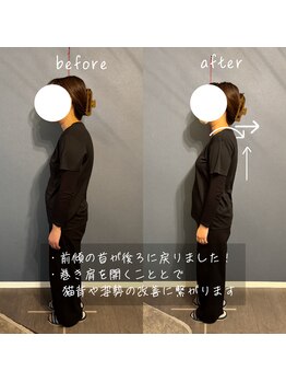 首の休日/【施術変化】首と肩がスッキリ♪