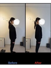 カピリナ(KaPilina)/ビフォーアフター