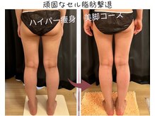 パチュプチ(Patchou petit)の雰囲気（マシン＆ゴットハンドテクニックで脂肪燃焼・デトックス・痩身◎）