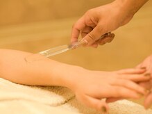 シェリール(Cherir)/部分脱毛