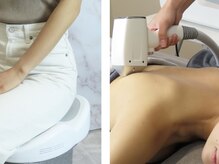 シード(SHE°)/フェムケアマシン