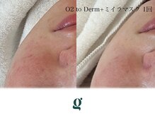 グレイスリリー(grace lily)/