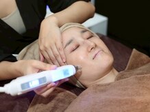 オルビナ(Orbina)