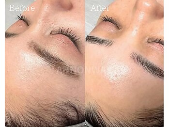 ポアラ(POARA)/毛穴/ワックス脱毛