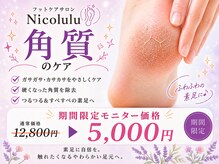 魚の目と巻き爪の専門店　フットケアサロン Nicolulu 大阪天満店【ニコルル】の雰囲気（期間限定！ガサガサかかと！つるつるな足で夏を過ごしましょう♪）