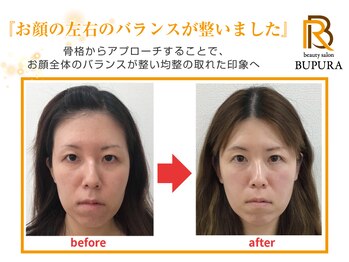 ブプラ つくば店(BUPURA)/before→after　５