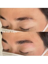 フレイズラピス(FRASE Lapis)/【ハリウッドブロウリフト】