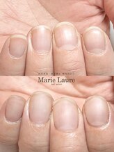 マリーロール 梅田店(Marie Laure)/自爪育成/深爪矯正/ネイルケア
