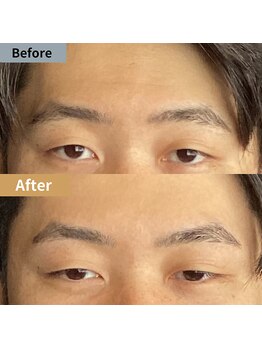 眉毛ハウス 吉祥寺店(眉毛HOUSE)/お客様の施術例(吉祥寺/東京)