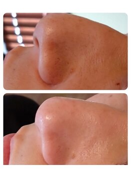 フロレゾン(Floraison)/毛穴レスフェイシャル