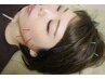 【学割U24】小顔/ニキビ予防 美容鍼＋ドライヘッドスパ ￥7620→￥5600
