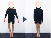 美デザイン 広島並木通り店(美.design)/☆美脚Ｏ脚矯正+美尻骨盤矯正