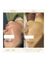 ラヴィエベル(la vie est belle)/フェイシャル＊光フェイシャル