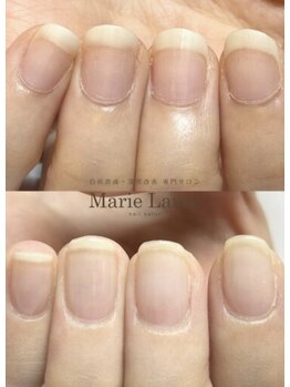 マリーロール 天王寺店(Marie Laure)/自爪育成/深爪矯正/ネイルケア