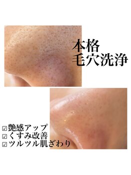 ウェリナ(Welina)/